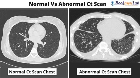 What should you do when a scan or test result is abnormal or.